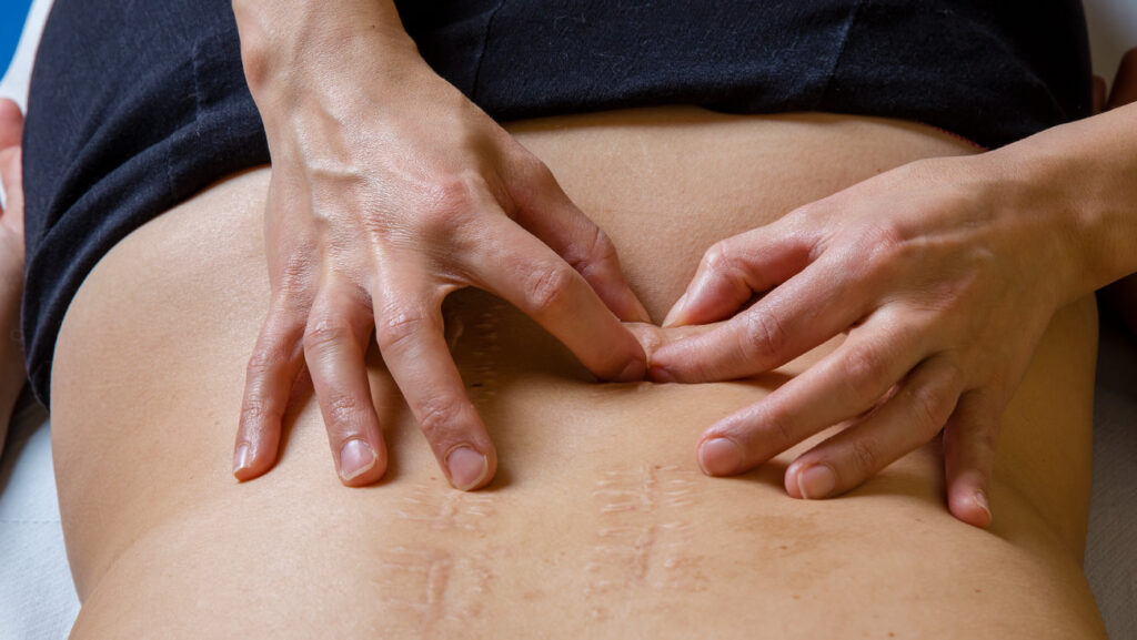 fisioterapia_dermatofunzionale_11a03851033d75f6b182b636c09c3009